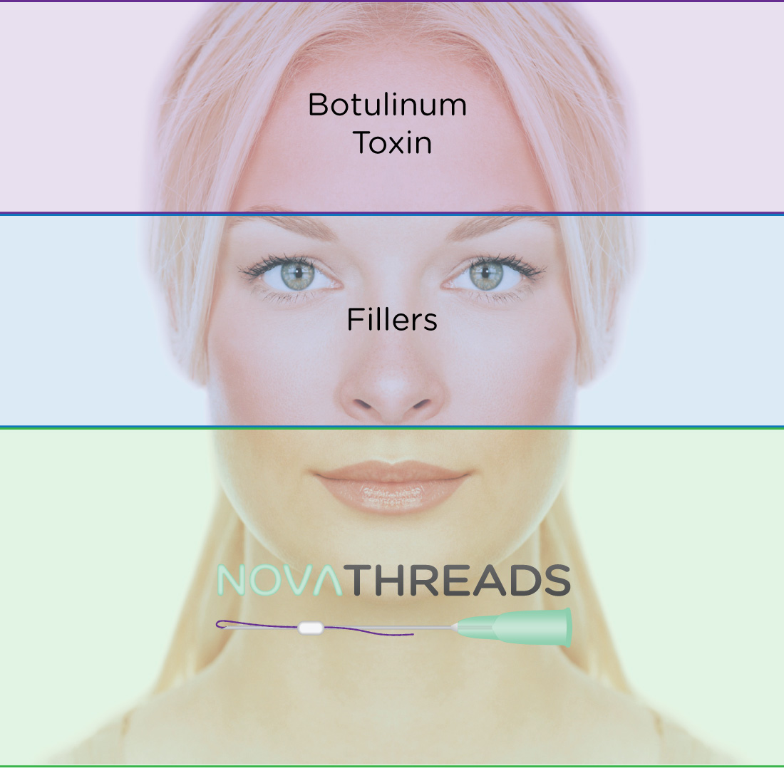 NovaThreads vs Botox vs Fillers
