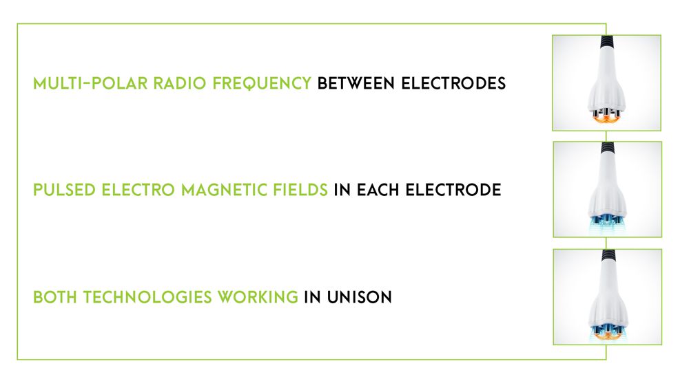 Venus Multi-Polar Radio Frequency Technology